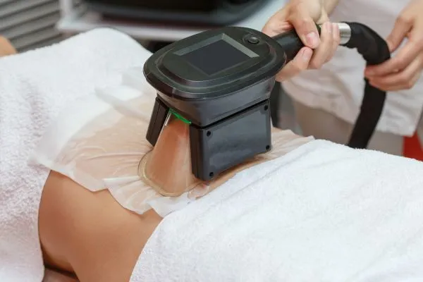 Image of person having fat freezing treatment to help weight gain Market Drayton