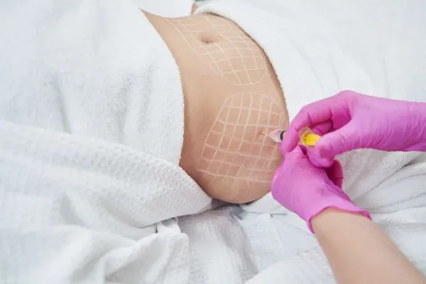 image of fat dissolving injections on love handles to help combat weight gain Market Drayton