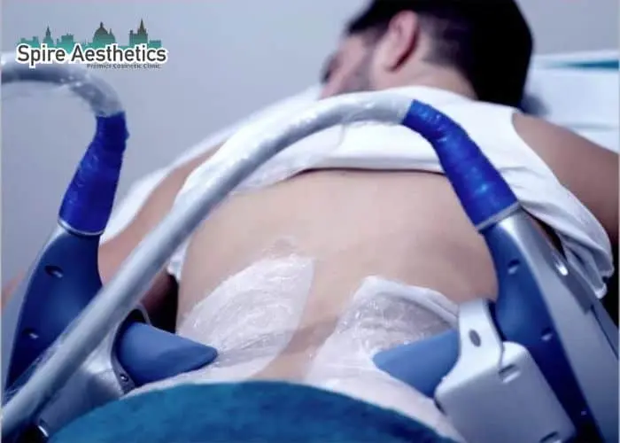 Man having fat freezing treatment done on love handles before a competitions Market Drayton to create a sculpted look.