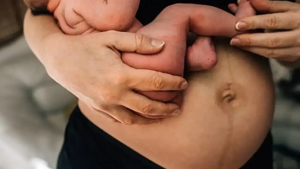 Why Is My Stomach Still Big After Pregnancy Market Drayton?