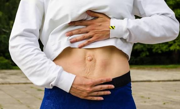 When Could Diastasis Recti Be the Missing Piece of the Puzzle Market Drayton?